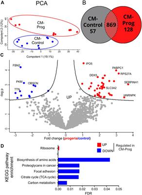 Modelling premature cardiac aging with induced pluripotent stem cells from a hutchinson-gilford Progeria Syndrome patient